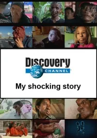 Постер сериала Моя ужасная история